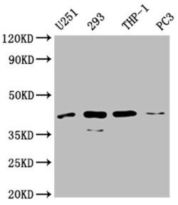SI-CLP Polyclonal Antibody:Antibodies, Polyclonal