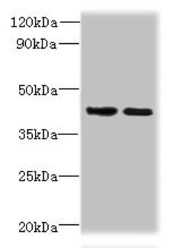 SI-CLP Polyclonal Antibody:Antibodies, Polyclonal
