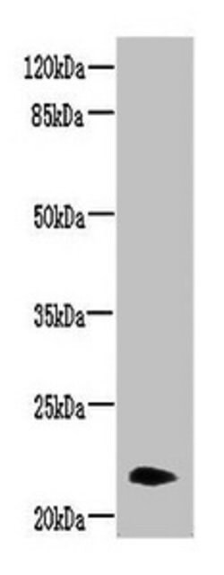 Invitrogen Neurensin 2 Polyclonal Antibody 100 μg; Unconjugated:Antibodies,