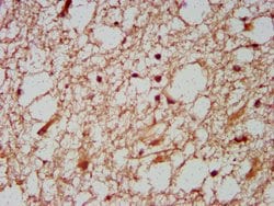 Invitrogen HOXD1 Polyclonal Antibody 100 μg; Unconjugated:Antibodies,
