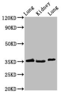Invitrogen HOXD1 Polyclonal Antibody 100 μg; Unconjugated:Antibodies,