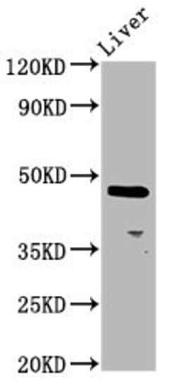 Invitrogen ALX4 Polyclonal Antibody 100 &mu;g; Unconjugated:Antibodies,