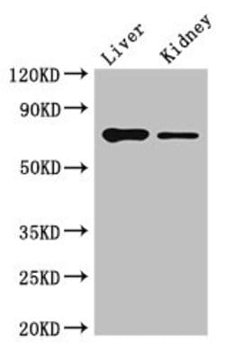 Invitrogen DEF6 Polyclonal Antibody 100 &mu;g; Unconjugated:Antibodies,