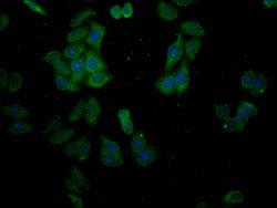 Invitrogen SLC28A3 Polyclonal Antibody 100 &mu;g; Unconjugated:Antibodies,