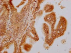 Invitrogen SLC28A3 Polyclonal Antibody 100 &mu;g; Unconjugated:Antibodies,