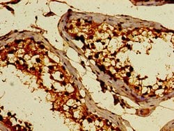 Invitrogen C3orf14 Polyclonal Antibody 100 μg; Unconjugated:Antibodies,