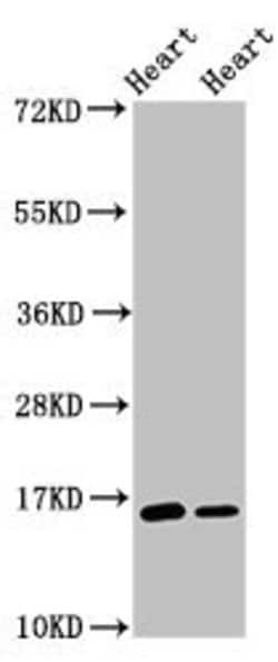 Invitrogen C3orf14 Polyclonal Antibody 100 μg; Unconjugated:Antibodies,