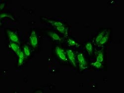 Invitrogen SMARCAL1 Polyclonal Antibody 100 &mu;g; Unconjugated:Antibodies,