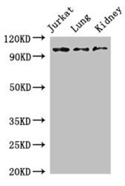 Invitrogen SMARCAL1 Polyclonal Antibody 100 &mu;g; Unconjugated:Antibodies,