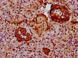 Invitrogen GLTSCR2 Polyclonal Antibody 100 &mu;g; Unconjugated:Antibodies,