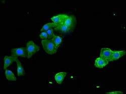 Invitrogen STARD9 Polyclonal Antibody 100 &mu;g; Unconjugated:Antibodies,