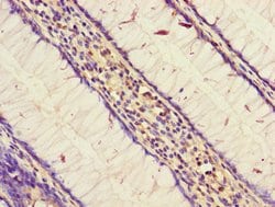 Invitrogen STARD9 Polyclonal Antibody 100 &mu;g; Unconjugated:Antibodies,