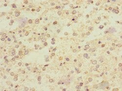 Invitrogen CHRNA9 Polyclonal Antibody 100 μL; Unconjugated:Antibodies,