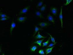 Invitrogen SLC23A1 Polyclonal Antibody 100 μg; Unconjugated:Antibodies,