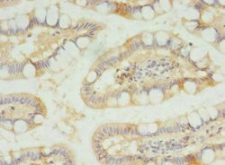 Invitrogen SLC23A1 Polyclonal Antibody 100 μg; Unconjugated:Antibodies,