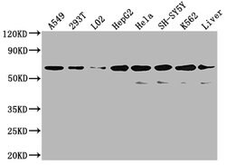 Invitrogen SLC23A1 Polyclonal Antibody 100 μg; Unconjugated:Antibodies,