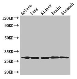 Invitrogen Rtp3 Polyclonal Antibody 100 &mu;g; Unconjugated:Anticorps,