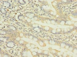 Invitrogen NUPL1 Polyclonal Antibody 100 &mu;g; Unconjugated:Antibodies,