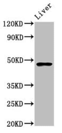 Invitrogen FUT8 Polyclonal Antibody 100 &mu;g; Unconjugated:Antibodies,