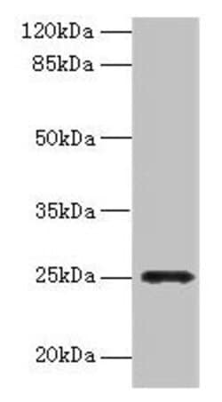Invitrogen FGFBP2 Polyclonal Antibody 100 &mu;g; Unconjugated:Antibodies,