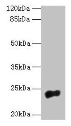 Invitrogen NACA2 Polyclonal Antibody 100 &mu;g | Buy Online | Invitrogen&trade; | Fisher Scientific