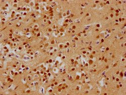 Invitrogen ADNP Polyclonal Antibody 100 &mu;L; Unconjugated:Antibodies,
