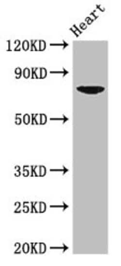 Invitrogen PRDM13 Polyclonal Antibody 100 &mu;g | Buy Online | Invitrogen&trade; | Fisher Scientific
