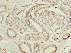 Invitrogen Actin-like 8 Polyclonal Antibody 100 &mu;g; Unconjugated:Antibodies,
