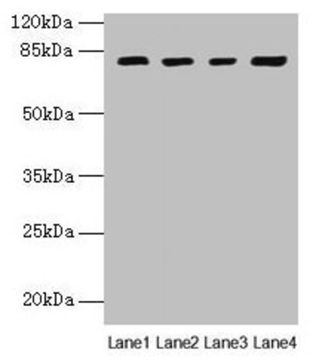 Invitrogen DHX35 Polyclonal Antibody 100 μg | Buy Online | Invitrogen ...