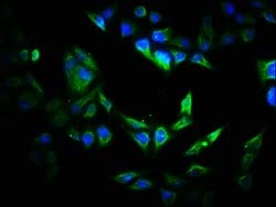 Invitrogen VIPAS39 Polyclonal Antibody 100 &mu;g; Unconjugated:Antibodies,