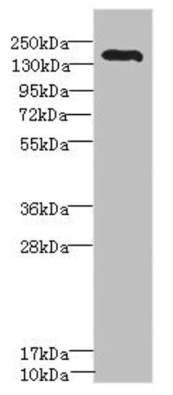 Invitrogen ROBO2 Polyclonal Antibody 100 &mu;L; Unconjugated:Antibodies,