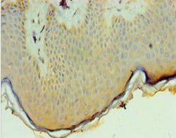 Invitrogen PNPLA3 Polyclonal Antibody 100 &mu;L; Unconjugated:Antibodies,