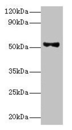 Invitrogen PNPLA3 Polyclonal Antibody 100 &mu;L; Unconjugated:Antibodies,