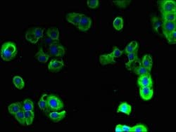 Invitrogen mPR gamma Polyclonal Antibody 100 μg; Unconjugated:Antibodies,