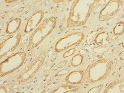 Invitrogen mPR gamma Polyclonal Antibody 100 μg; Unconjugated:Antibodies,
