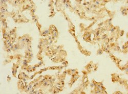 Invitrogen mPR gamma Polyclonal Antibody 100 μg; Unconjugated:Antibodies,