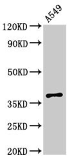 Invitrogen mPR gamma Polyclonal Antibody 100 μg; Unconjugated:Antibodies,