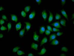 Invitrogen NEDL2 Polyclonal Antibody 100 μg; Unconjugated:Antibodies,