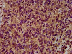 Invitrogen NEDL2 Polyclonal Antibody 100 μg; Unconjugated:Antibodies,
