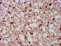 Invitrogen NEDL2 Polyclonal Antibody 100 μg; Unconjugated:Antibodies,