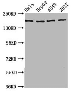 Invitrogen NEDL2 Polyclonal Antibody 100 μg; Unconjugated:Antibodies,