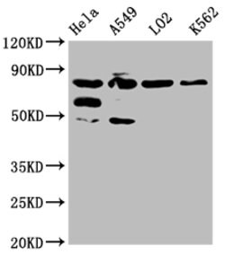 Invitrogen MTRR Polyclonal Antibody 100 &mu;g; Unconjugated:Antibodies,