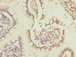 Invitrogen DHDH Polyclonal Antibody 100 &mu;L; Unconjugated:Antibodies,