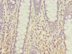Invitrogen DHDH Polyclonal Antibody 100 &mu;L; Unconjugated:Antibodies,