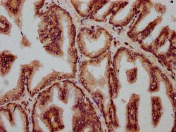 Invitrogen FBXO10 Polyclonal Antibody 100 &mu;g; Unconjugated:Antibodies,