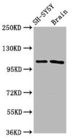 Invitrogen FBXO10 Polyclonal Antibody 100 &mu;g; Unconjugated:Antibodies,