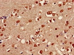 Invitrogen SHOC2 Polyclonal Antibody 100 &mu;g; Unconjugated:Antibodies,