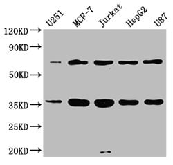 Invitrogen SHOC2 Polyclonal Antibody 100 &mu;g; Unconjugated:Antibodies,
