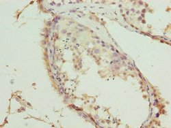 Invitrogen TRMT6 Polyclonal Antibody 100 &mu;g; Unconjugated:Antibodies,