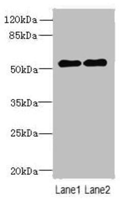Invitrogen TRMT6 Polyclonal Antibody 100 &mu;g; Unconjugated:Antibodies,